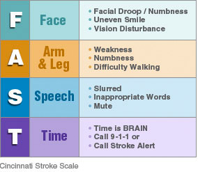 Stroke Syndromes Chart